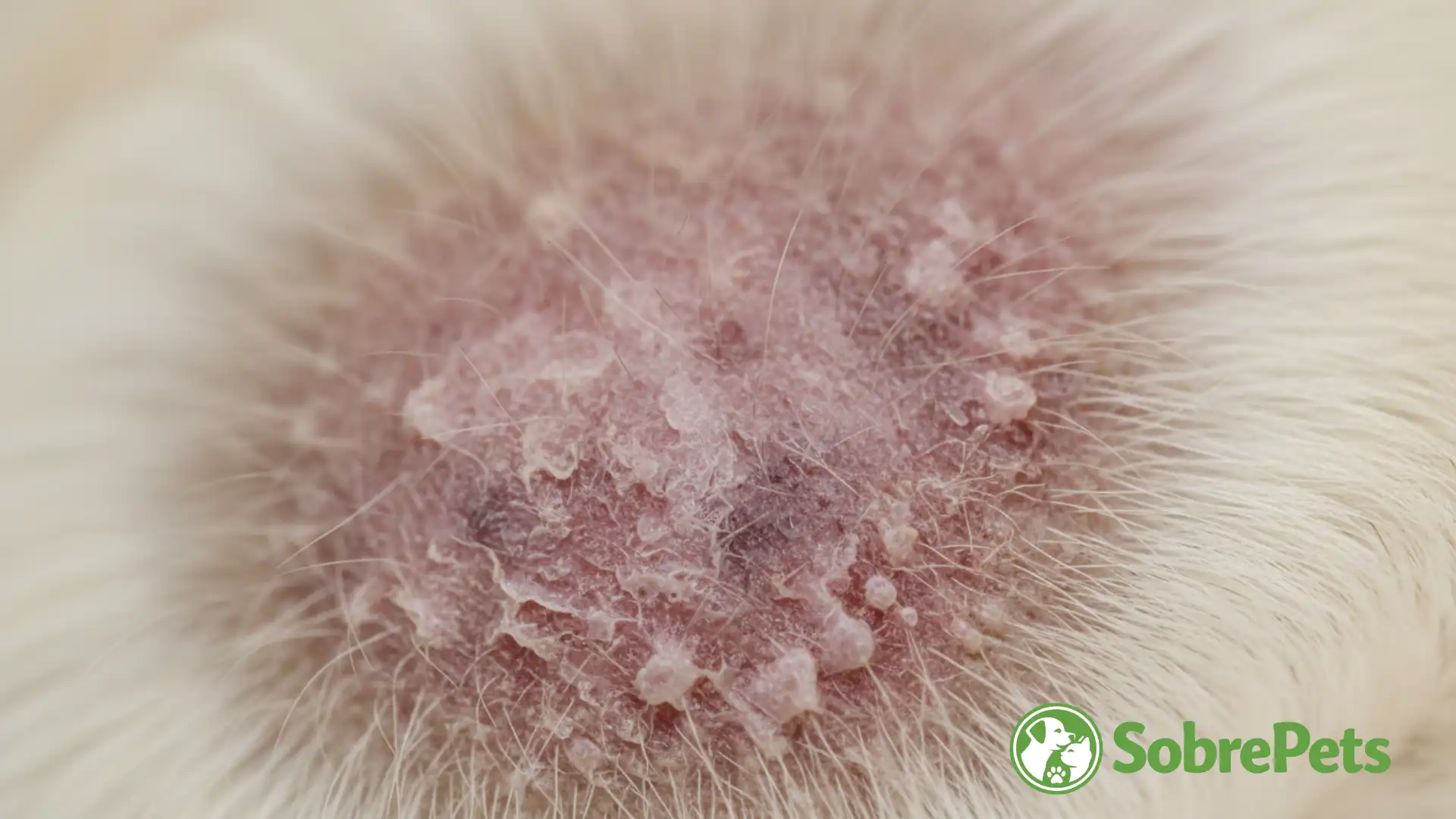 A Epidemia Silenciosa da Coceira